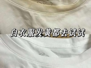 白衣服为什么会发黄 白衣服为什么会发黄？这些原因你知道吗？