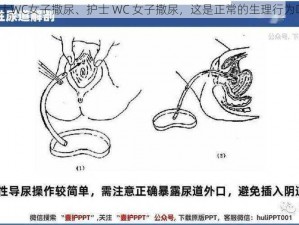 护士WC女子撒尿、护士 WC 女子撒尿，这是正常的生理行为吗？