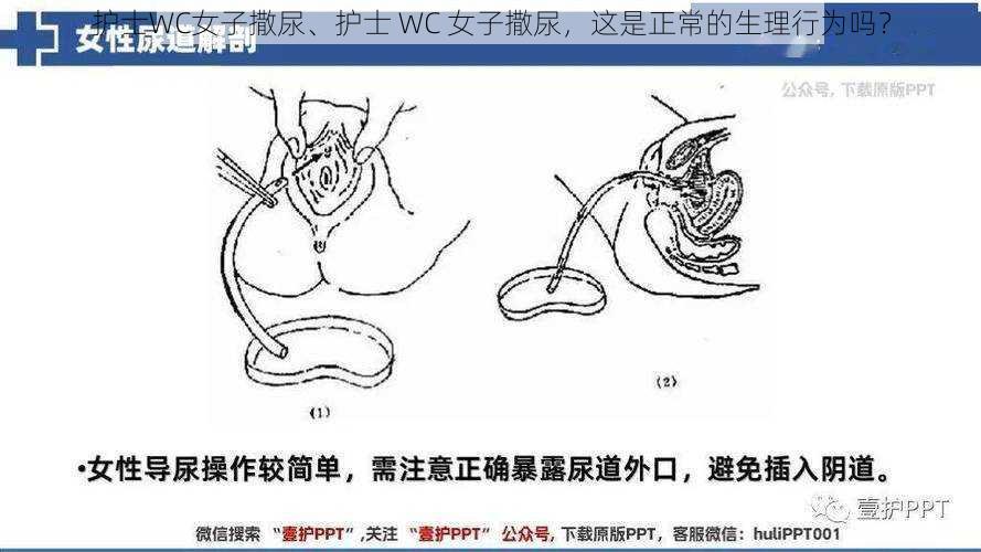 护士WC女子撒尿、护士 WC 女子撒尿，这是正常的生理行为吗？