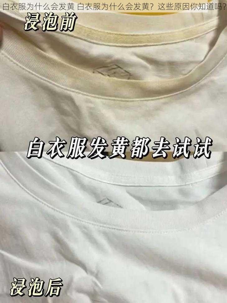 白衣服为什么会发黄 白衣服为什么会发黄？这些原因你知道吗？